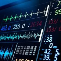 ECG ECG
