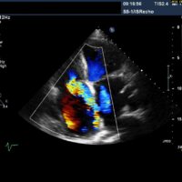 Echocardiography Echocardiography